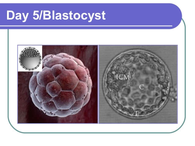 BLASTOCYST CULTURE from Mothercareivf - Top Infertility Centre & Andrology Institute in Surat