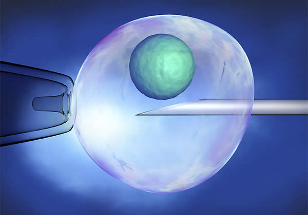 LASER ASSISTED HATCHING from Mothercareivf - Top Infertility Centre & Andrology Institute in Surat